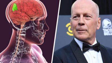 Bruce Willis health