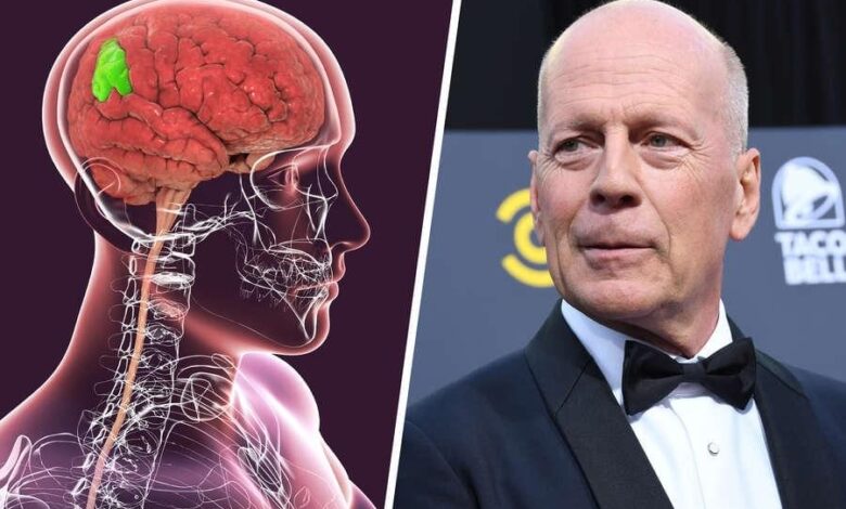 Bruce Willis health